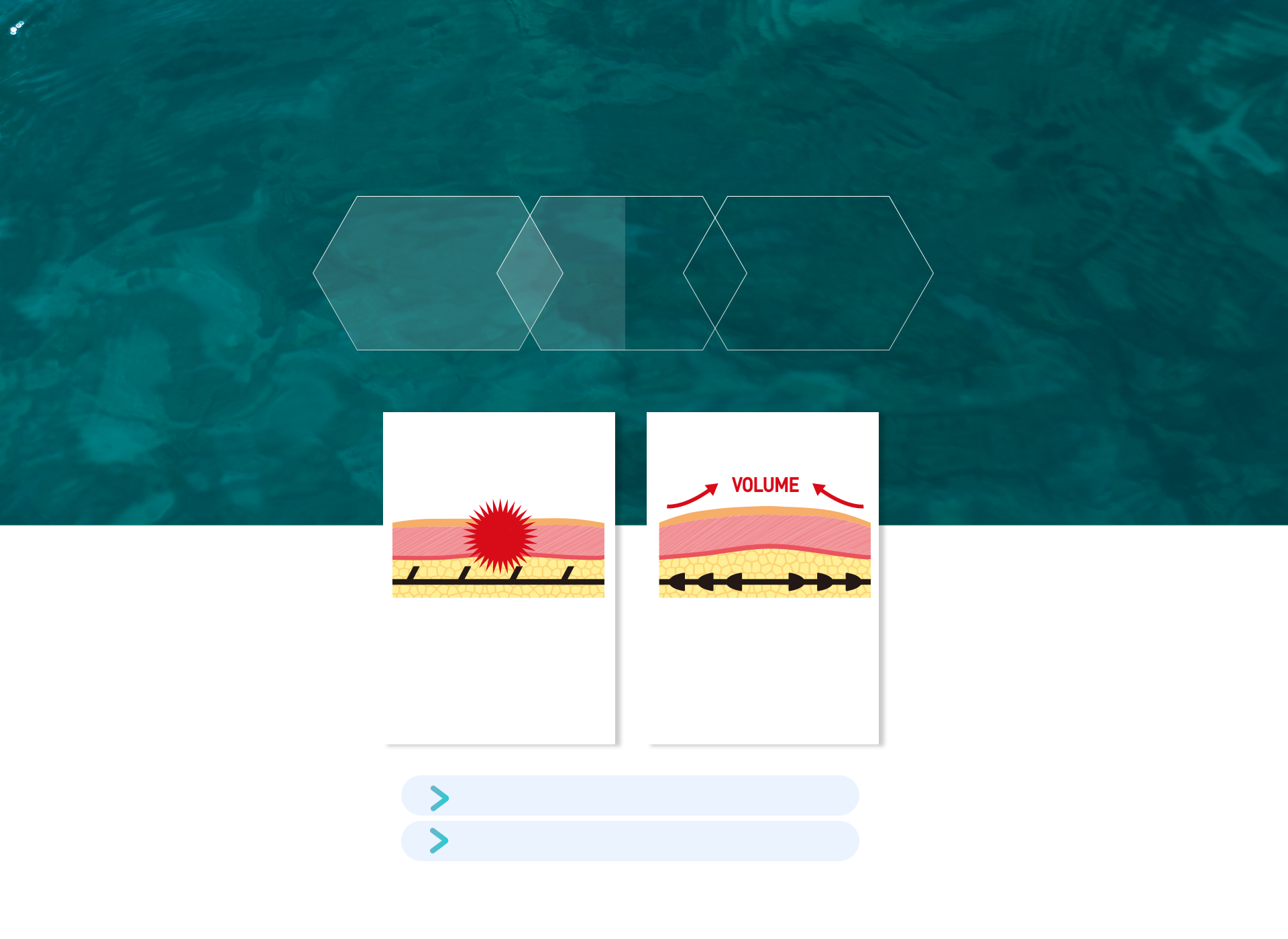 普通线雕 vs 轮廓软线比较