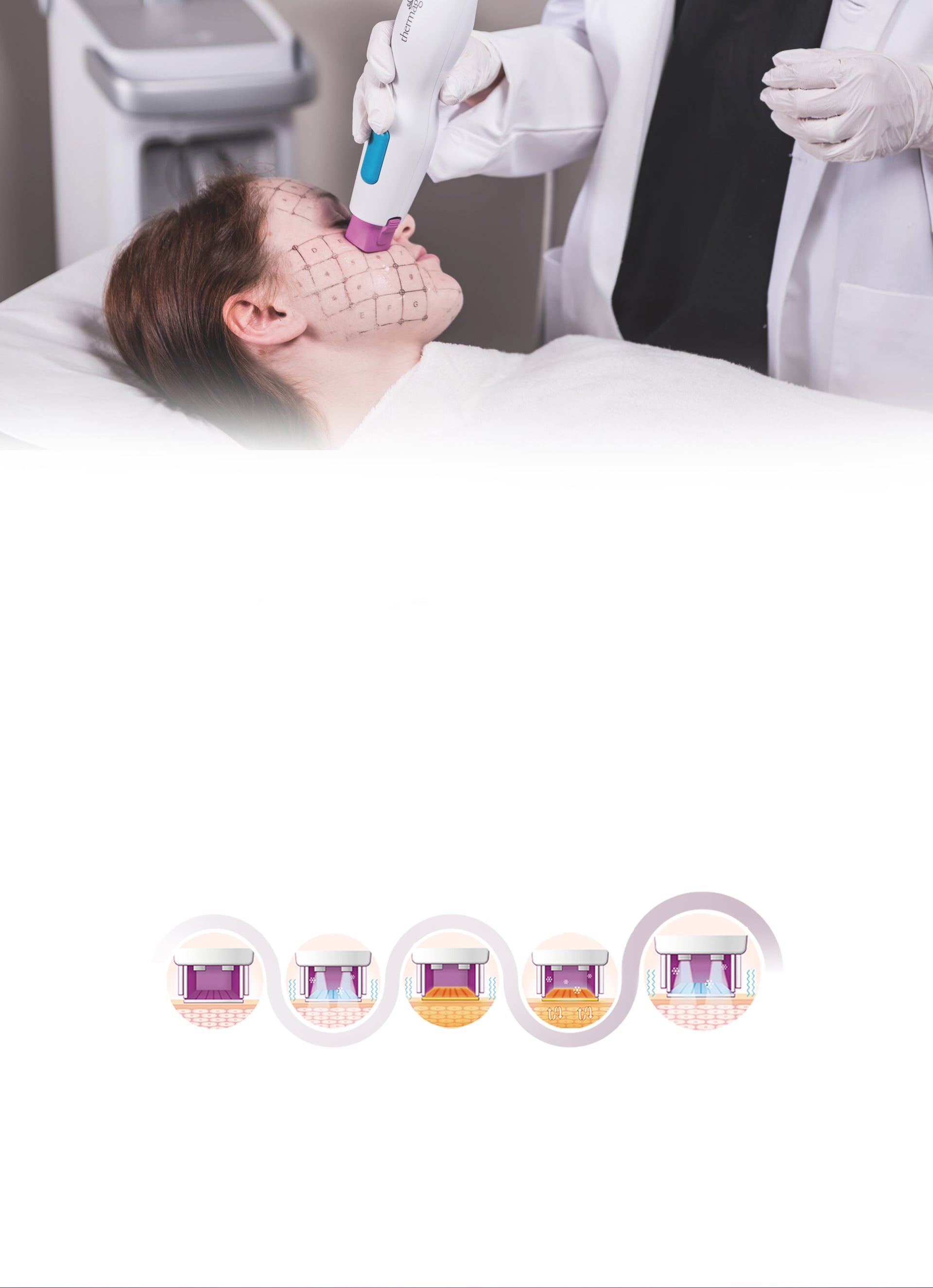 美版热玛吉FLX施术原理及步骤