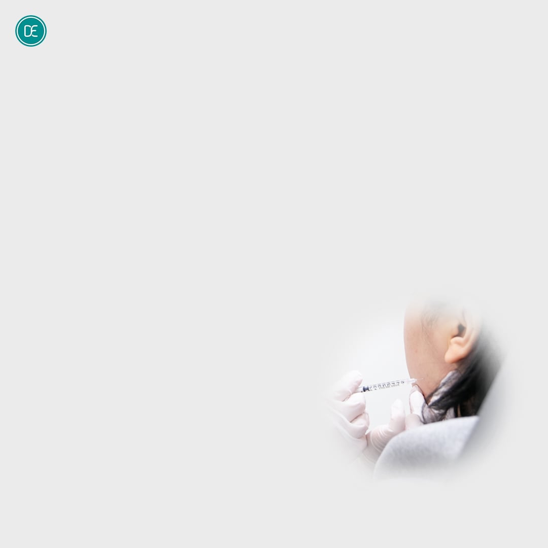 轮廓针